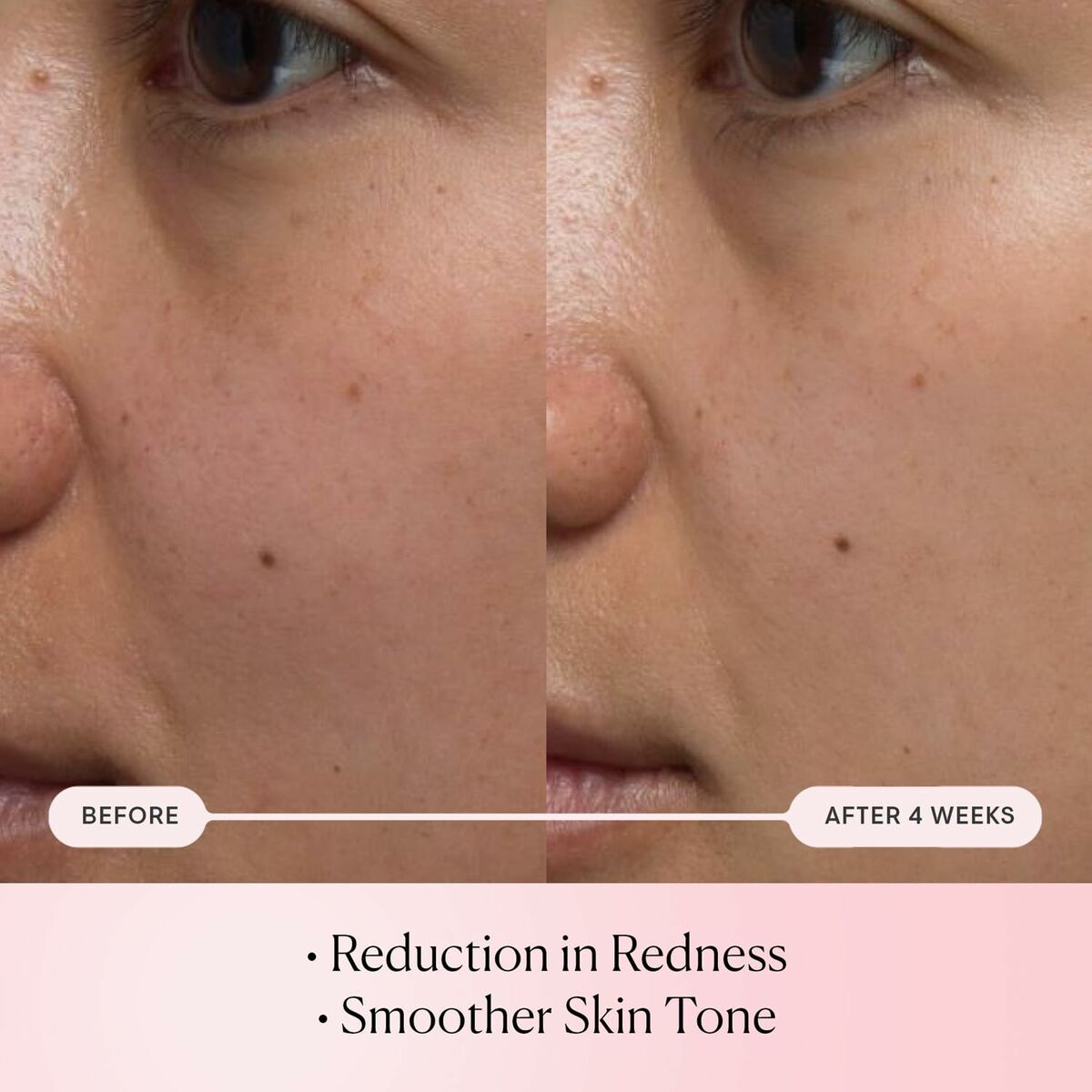 V6H8B0E418004FD1E9984BCA8C4C1070DD1R6617800P3