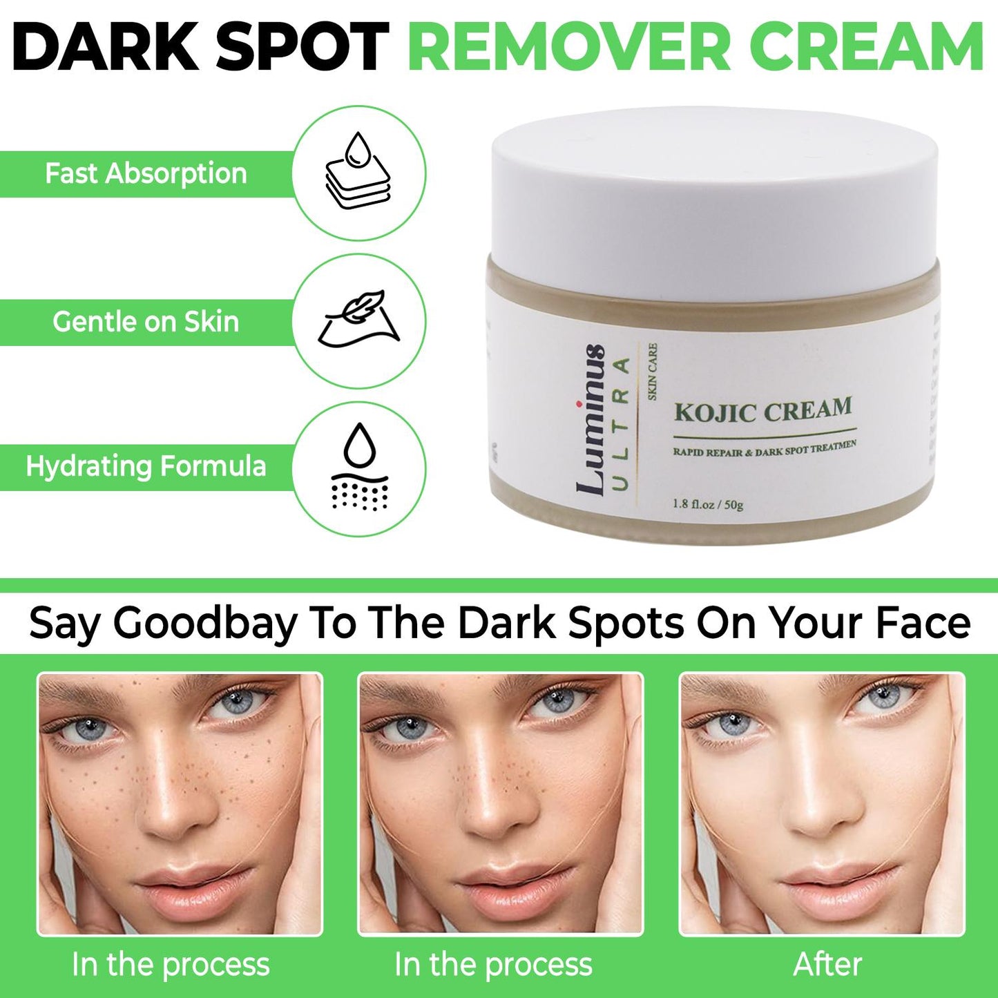 Kojic Acid Blackhead Cream-2