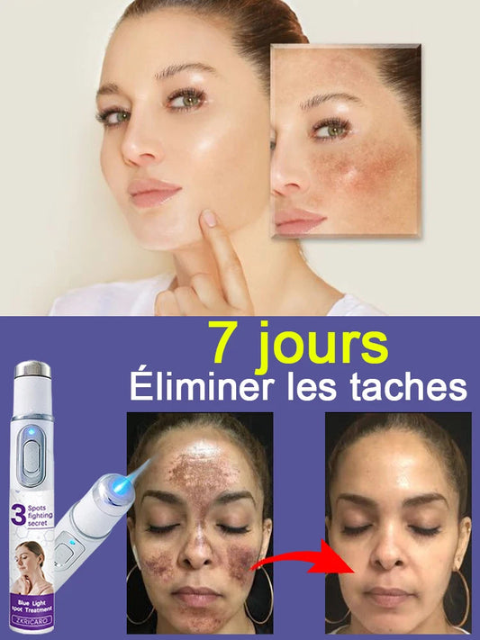 Éliminez le mélasma et les taches brunes sans douleur Hive JFA & TA Store