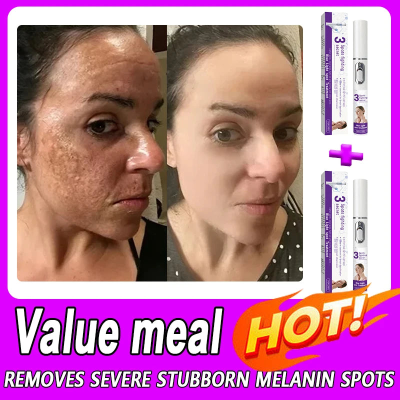 Éliminez le mélasma et les taches brunes sans douleur Hive JFA & TA Store