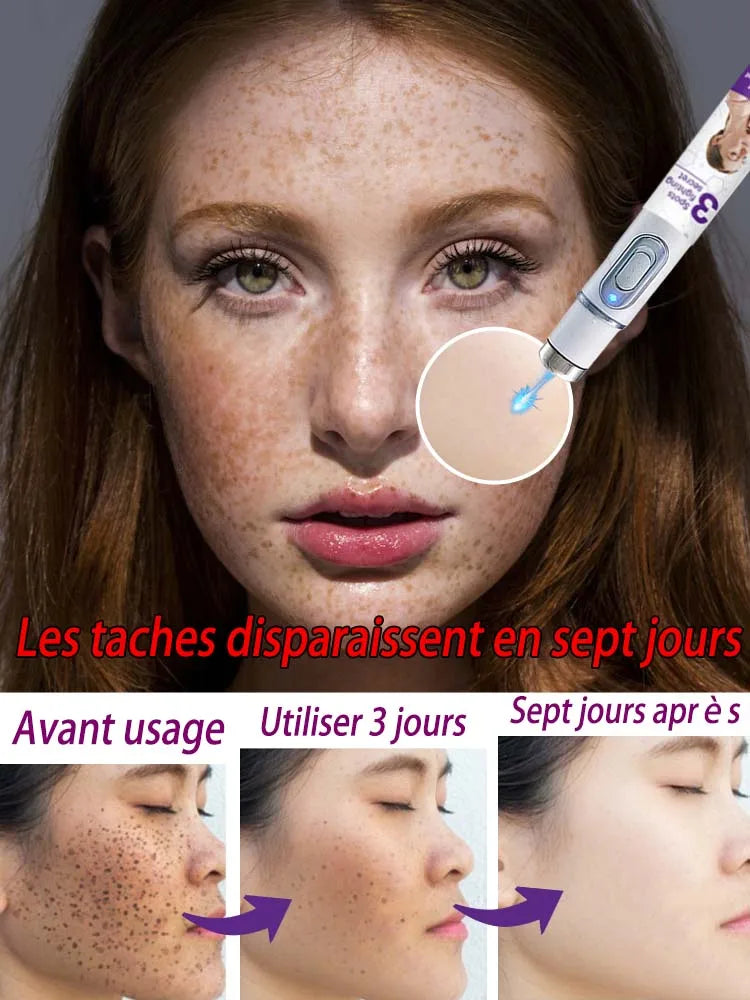 Éliminez le mélasma et les taches brunes sans douleur Hive JFA & TA Store