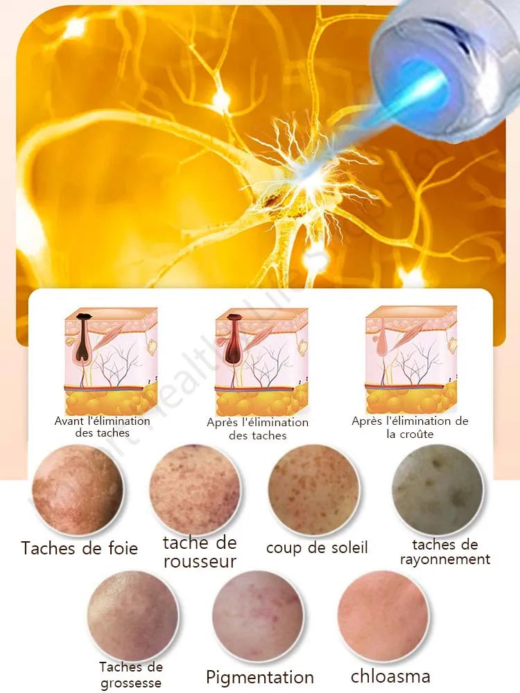 Éliminez le mélasma et les taches brunes sans douleur Hive JFA & TA Store