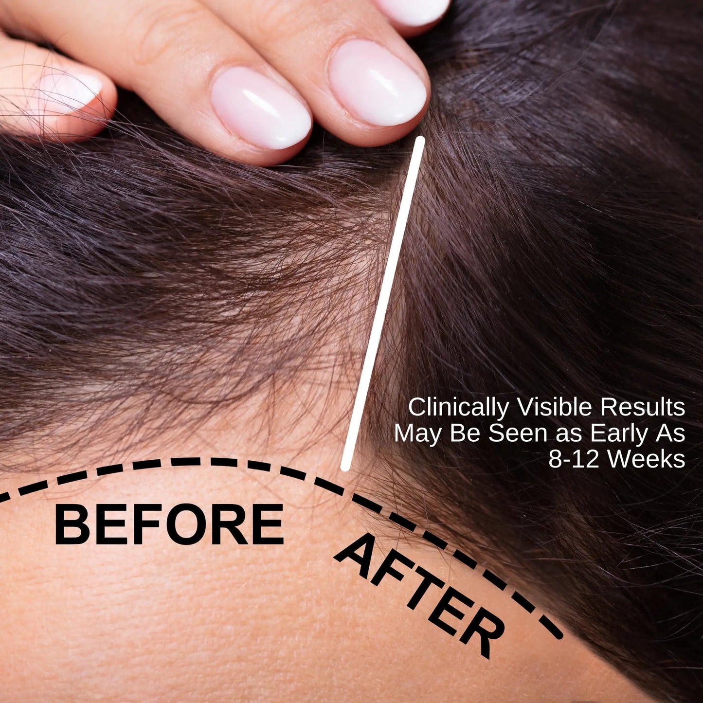 Ammuri Total Hair Repair Serum: Hair Loss Solution-2